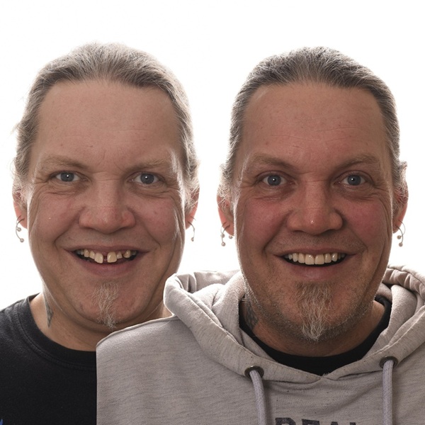 Estetisk behandling
